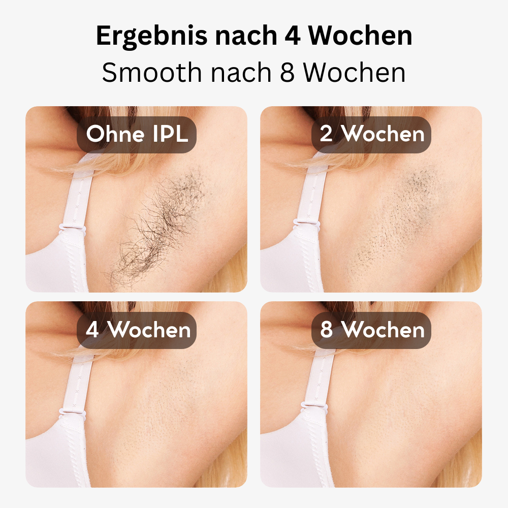 Professioneller IPL - Für ein Haarfreies Gefühl