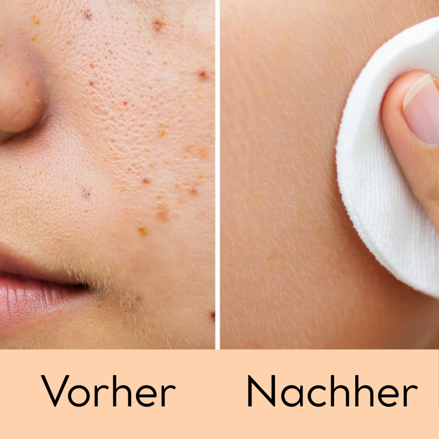 Professioneller IPL - Für ein Haarfreies Gefühl